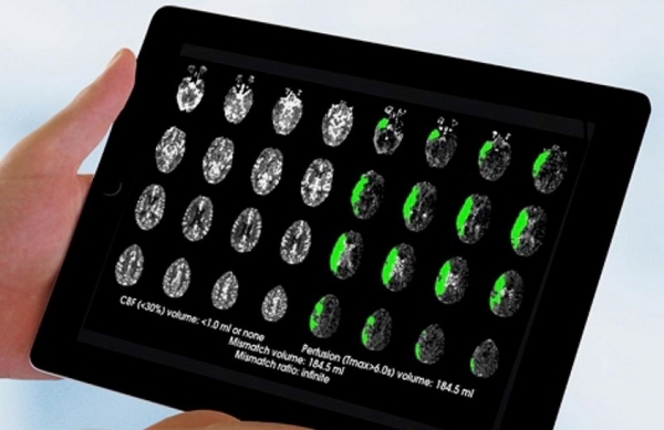 Brain imaging technology